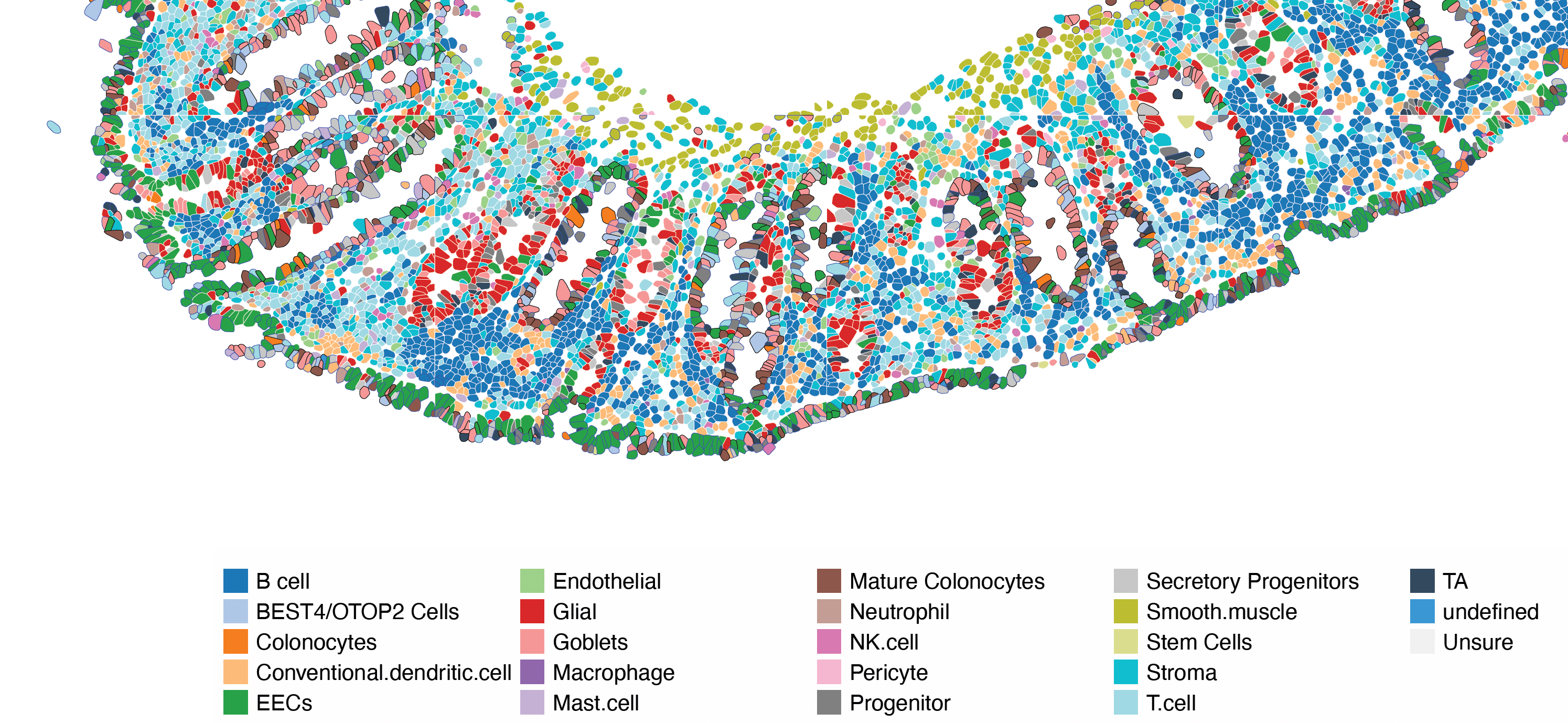 spatial transcriptomics